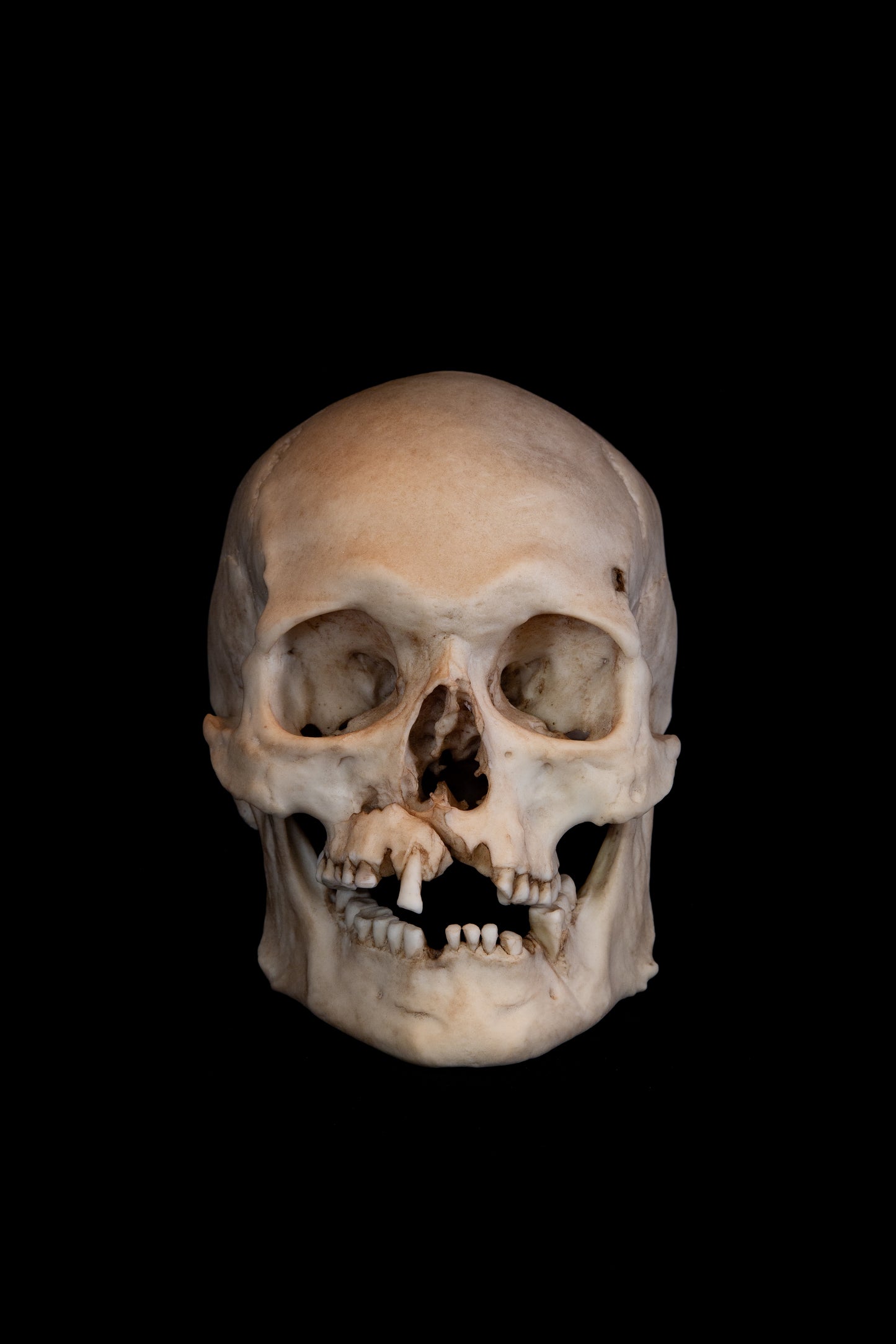 Viking Skull Replica – Life-Sized Historical Display Piece