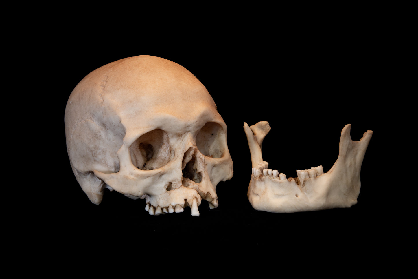 Viking Skull Replica – Life-Sized Historical Display Piece